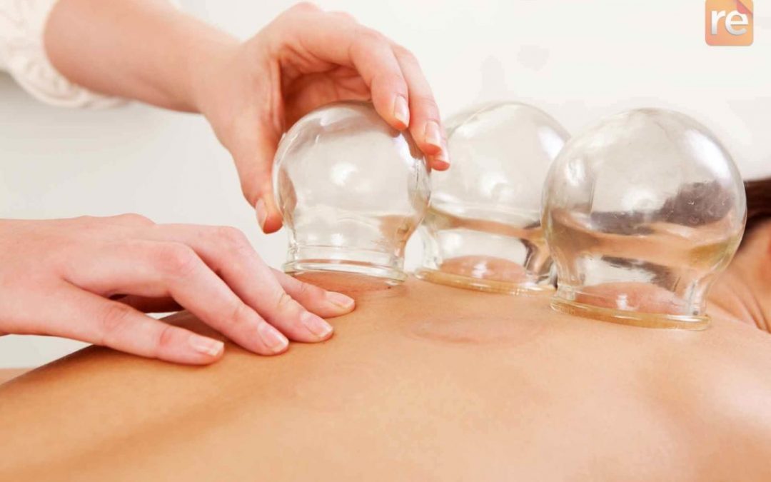 Have you tried cupping yet?