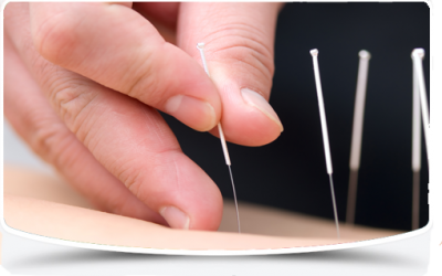Relief from neck pain with dry needling